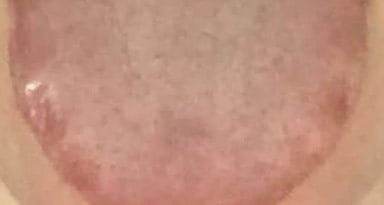 জিহ্বার রঙ লুকানো স্বাস্থ্য রহস্য