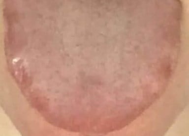 জিহ্বার রঙ লুকানো স্বাস্থ্য রহস্য