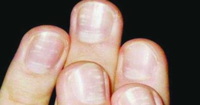 What nails tell about our health
