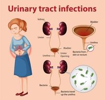 urine infection 