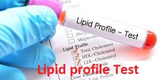 Lipid profile পরীক্ষা কি?