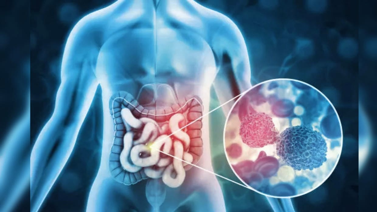 সতর্কবার্তা Clone Cancer নিয়ে যা জানা জরুরি