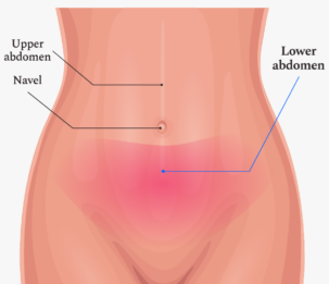 Lower Abdominal Pain
