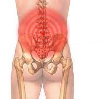 Low back pain (LBP) 0704