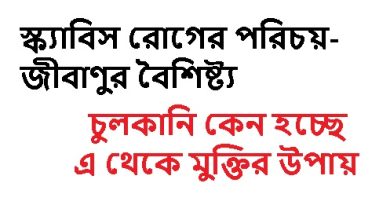 Scabies Alert লক্ষণগুলো দেখলেই সতর্ক হন